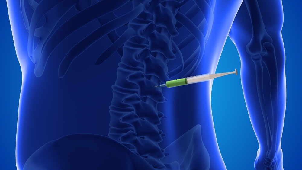 Therapeutic angiogenesis for patients with limb ischaemia by autologous ...